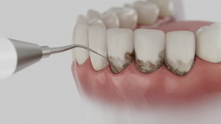 Reliable Emergency Dentist contractor in Oakbrook, KY by Smile Center Dentistry